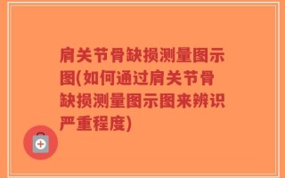 肩关节骨缺损测量图示图(如何通过肩关节骨缺损测量图示图来辨识严重程度)