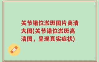 关节错位淤斑图片高清大图(关节错位淤斑高清图，呈现真实症状)