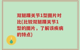 双腿踝关节1型图片对比(比较双腿踝关节1型的图片，了解该疾病的特点)