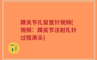 踝关节扎留置针视频(视频：踝关节注射扎针过程演示)
