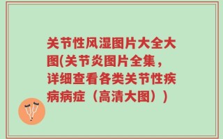 关节性风湿图片大全大图(关节炎图片全集，详细查看各类关节性疾病病症（高清大图）)