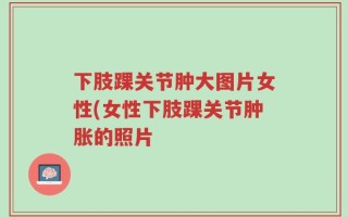 下肢踝关节肿大图片女性(女性下肢踝关节肿胀的照片