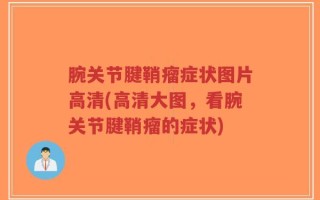 腕关节腱鞘瘤症状图片高清(高清大图，看腕关节腱鞘瘤的症状)