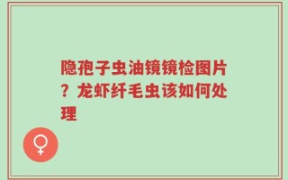 隐孢子虫油镜镜检图片？龙虾纤毛虫该如何处理