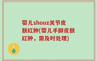 婴儿shouz关节皮肤红肿(婴儿手脚皮肤红肿，需及时处理)