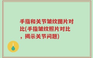 手指和关节皱纹图片对比(手指皱纹照片对比，揭示关节问题)