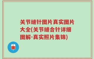 关节缝针图片真实图片大全(关节缝合针详细图解-真实照片集锦)
