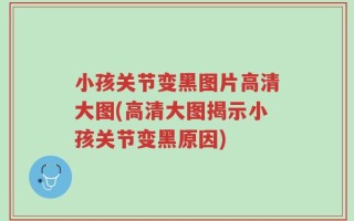 小孩关节变黑图片高清大图(高清大图揭示小孩关节变黑原因)
