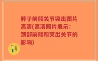 脖子前倾关节突出图片高清(高清照片展示：颈部前倾和突出关节的影响)