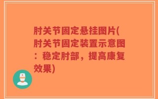 肘关节固定悬挂图片(肘关节固定装置示意图：稳定肘部，提高康复效果)