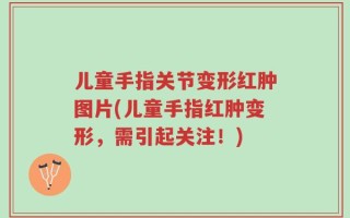 儿童手指关节变形红肿图片(儿童手指红肿变形，需引起关注！)