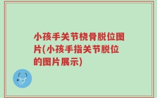 小孩手关节桡骨脱位图片(小孩手指关节脱位的图片展示)