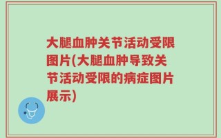 大腿血肿关节活动受限图片(大腿血肿导致关节活动受限的病症图片展示)