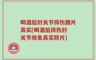 喝酒后肘关节摔伤图片真实(喝酒后摔伤肘 关节现象真实照片)