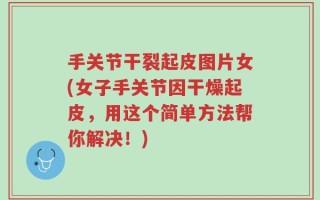手关节干裂起皮图片女(女子手关节因干燥起皮，用这个简单方法帮你解决！)