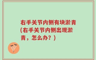 右手关节内侧有块淤青(右手关节内侧出现淤青，怎么办？)