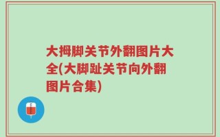 大拇脚关节外翻图片大全(大脚趾关节向外翻图片合集)