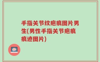 手指关节纹疤痕图片男生(男性手指关节疤痕痕迹图片)