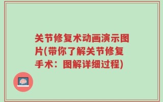 关节修复术动画演示图片(带你了解关节修复手术：图解详细过程)