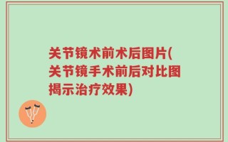 关节镜术前术后图片(关节镜手术前后对比图揭示治疗效果)