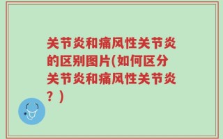 关节炎和痛风性关节炎的区别图片(如何区分关节炎和痛风性关节炎？)