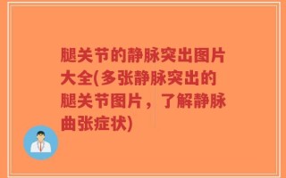 腿关节的静脉突出图片大全(多张静脉突出的腿关节图片，了解静脉曲张症状)