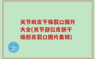 关节蜕皮干燥裂口图片大全(关节部位皮肤干燥脱皮裂口图片集锦)