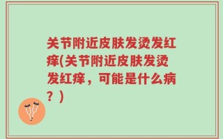 关节附近皮肤发烫发红痒(关节附近皮肤发烫发红痒，可能是什么病？)