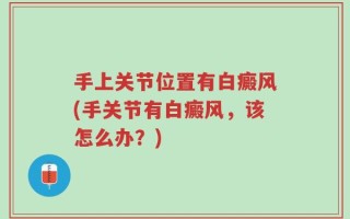 手上关节位置有白癜风(手关节有白癜风，该怎么办？)