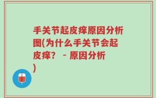 手关节起皮痒原因分析图(为什么手关节会起皮痒？ - 原因分析)