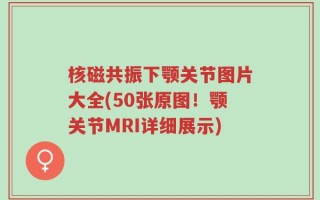 核磁共振下颚关节图片大全(50张原图！颚关节MRI详细展示)