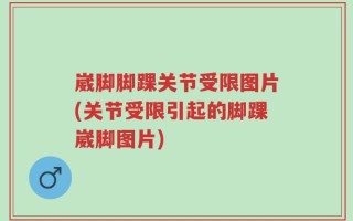 崴脚脚踝关节受限图片(关节受限引起的脚踝崴脚图片)