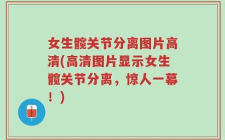 女生髋关节分离图片高清(高清图片显示女生髋关节分离，惊人一幕！)