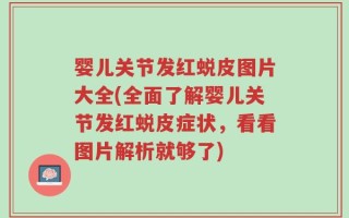 婴儿关节发红蜕皮图片大全(全面了解婴儿关节发红蜕皮症状，看看图片解析就够了)