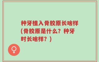 种牙植入骨胶原长啥样(骨胶原是什么？种牙时长啥样？)
