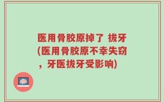 医用骨胶原掉了 拔牙(医用骨胶原不幸失窃，牙医拔牙受影响)
