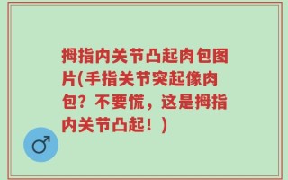 拇指内关节凸起肉包图片(手指关节突起像肉包？不要慌，这是拇指内关节凸起！)
