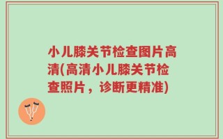 小儿膝关节检查图片高清(高清小儿膝关节检查照片，诊断更精准)