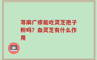 荨麻广疹能吃灵芝孢子粉吗？血灵芝有什么作用