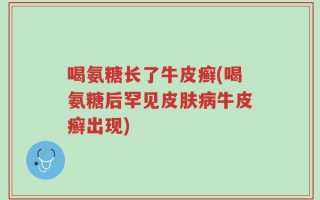 喝氨糖长了牛皮癣(喝氨糖后罕见皮肤病牛皮癣出现)