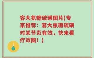 容大氨糖硫磺图片(专家推荐：容大氨糖硫磺对关节炎有效，快来看疗效图！)
