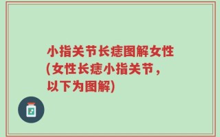 小指关节长痣图解女性(女性长痣小指关节，以下为图解)