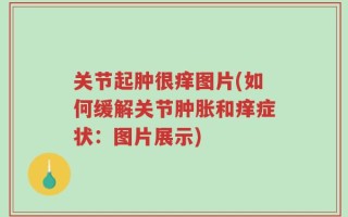 关节起肿很痒图片(如何缓解关节肿胀和痒症状：图片展示)