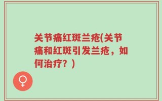 关节痛红斑兰疮(关节痛和红斑引发兰疮，如何治疗？)