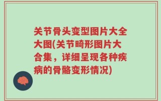 关节骨头变型图片大全大图(关节畸形图片大合集，详细呈现各种疾病的骨骼变形情况)
