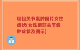 腿粗关节囊肿图片女性症状(女性腿部关节囊肿症状及图示)