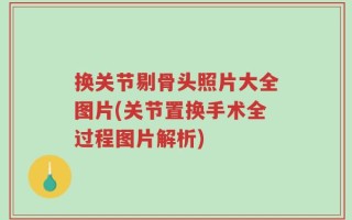 换关节剔骨头照片大全图片(关节置换手术全过程图片解析)