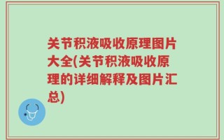 关节积液吸收原理图片大全(关节积液吸收原理的详细解释及图片汇总)