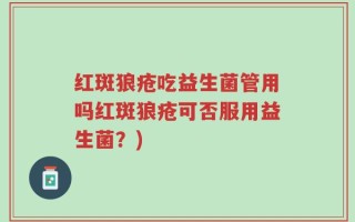 红斑狼疮吃益生菌管用吗红斑狼疮可否服用益生菌？)