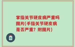 掌指关节硬皮病严重吗图片(手指关节硬皮病是否严重？附图片)